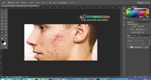 Cara Menghilangkan Jerawat di Photoshop Android