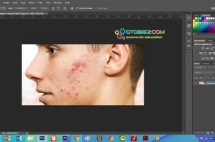 Cara Menghilangkan Jerawat di Photoshop Android