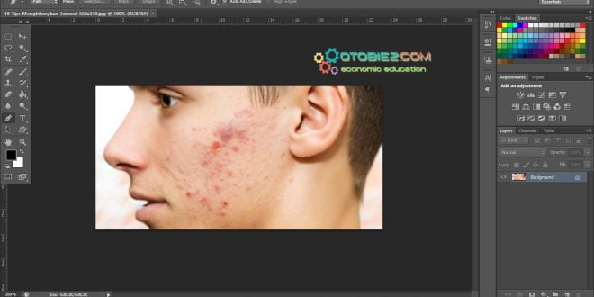 Cara Menghilangkan Jerawat di Photoshop Android