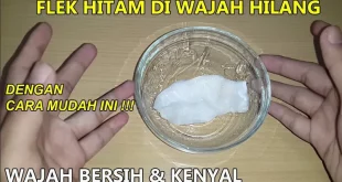 cara menghilangkan flek hitam dalam 1 jam 0