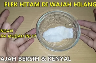 cara menghilangkan flek hitam dalam 1 jam 0